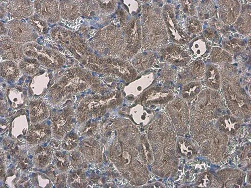 Immunohistochemistry (Formalin/PFA-fixed paraffin-embedded sections) - Anti-MICU2 antibody (AB101465)