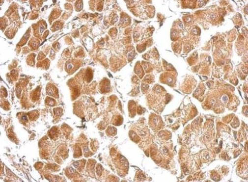 Immunohistochemistry (Formalin/PFA-fixed paraffin-embedded sections) - Anti-MICU2 antibody (AB101465), expandable thumbnail