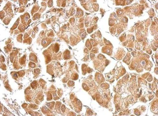 Immunohistochemistry (Formalin/PFA-fixed paraffin-embedded sections) - Anti-MICU2 antibody (AB101465)