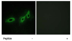 Immunocytochemistry/ Immunofluorescence - Anti-MID1 antibody (AB70770), expandable thumbnail