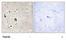 Immunohistochemistry (Formalin/PFA-fixed paraffin-embedded sections) - Anti-MID1 antibody (AB70770), expandable thumbnail