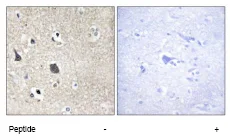 Immunohistochemistry (Formalin/PFA-fixed paraffin-embedded sections) - Anti-MID1 antibody (AB70770)