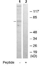 Western blot - Anti-MID1 antibody (AB70770), expandable thumbnail