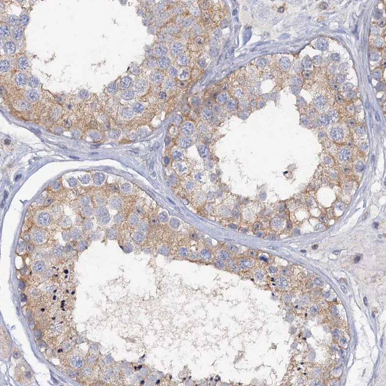 Immunohistochemistry (Formalin/PFA-fixed paraffin-embedded sections) - Anti-MID1IP1 antibody (AB224550)