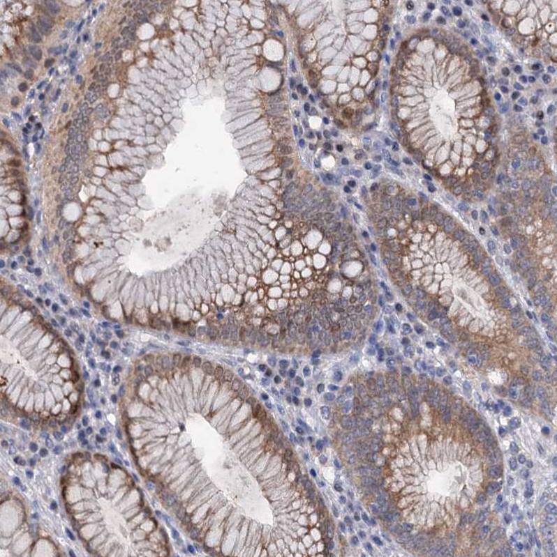 Immunohistochemistry (Formalin/PFA-fixed paraffin-embedded sections) - Anti-MID1IP1 antibody (AB224550), expandable thumbnail