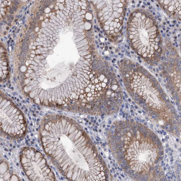 Immunohistochemistry (Formalin/PFA-fixed paraffin-embedded sections) - Anti-MID1IP1 antibody (AB224550)