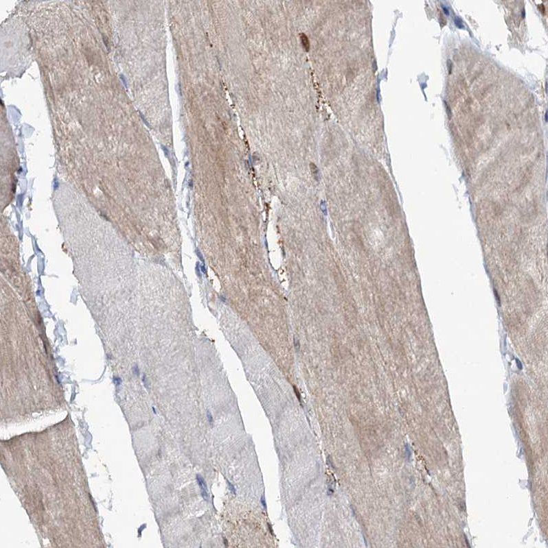 Immunohistochemistry (Formalin/PFA-fixed paraffin-embedded sections) - Anti-MID1IP1 antibody (AB224550), expandable thumbnail