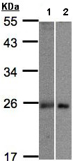 Western blot - Anti-MID1IP1 antibody (AB97806), expandable thumbnail