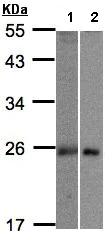 Western blot - Anti-MID1IP1 antibody (AB97806)
