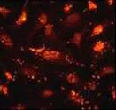 Immunocytochemistry/ Immunofluorescence - Anti-Midkine antibody [EP1143Y] (AB52637)