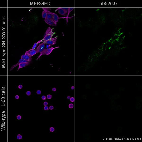 Immunocytochemistry/ Immunofluorescence - Anti-Midkine antibody [EP1143Y] (AB52637)