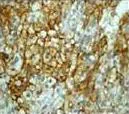 Immunohistochemistry (Formalin/PFA-fixed paraffin-embedded sections) - Anti-Midkine antibody [EP1143Y] (AB52637)