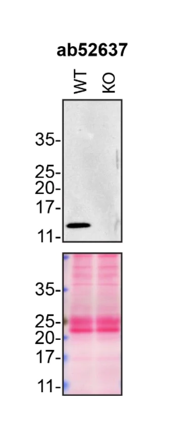 Western blot - Anti-Midkine antibody [EP1143Y] (AB52637)