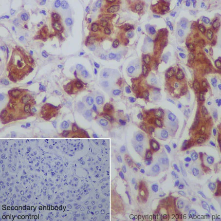 Western blot - Anti-Midkine antibody [EP1143Y] (AB52637)