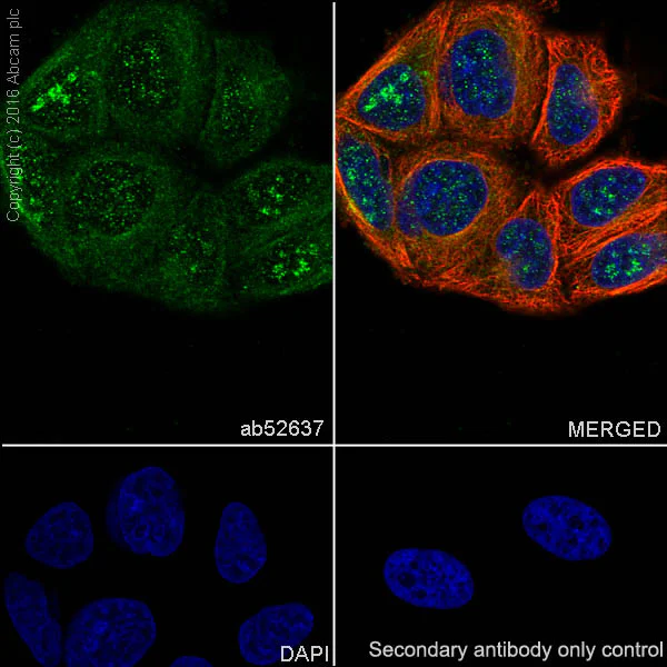 Immunocytochemistry/ Immunofluorescence - Anti-Midkine antibody [EP1143Y] - BSA and Azide free (AB236781)