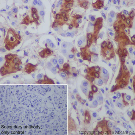 Western blot - Anti-Midkine antibody [EP1143Y] - BSA and Azide free (AB236781)