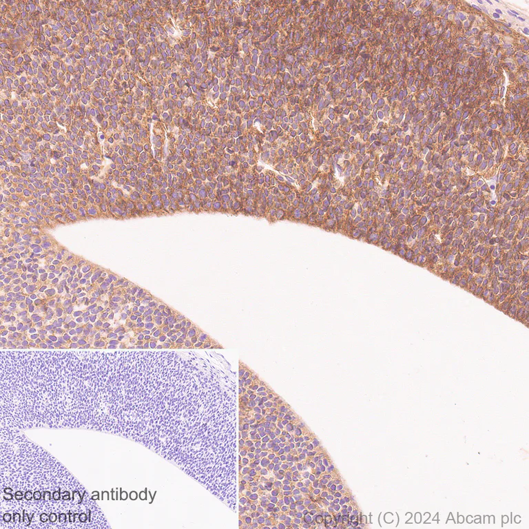 Immunohistochemistry (Formalin/PFA-fixed paraffin-embedded sections) - Anti-Midkine antibody [EPR29075-34] (AB318144)