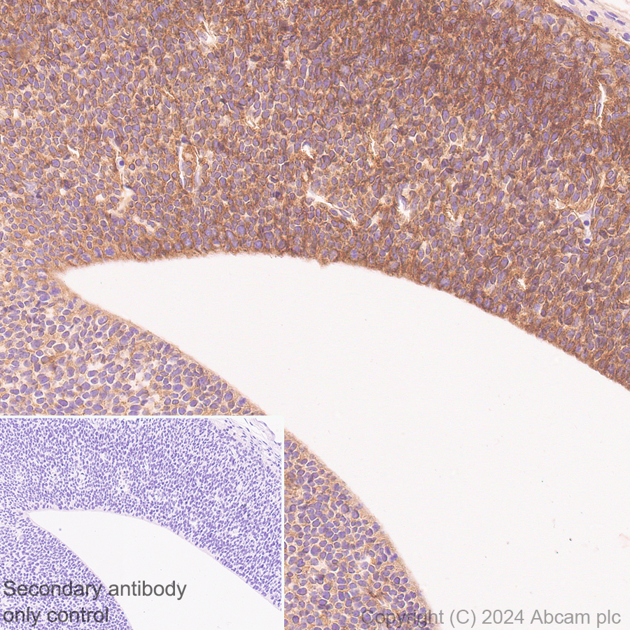 Immunohistochemistry (Formalin/PFA-fixed paraffin-embedded sections) - Anti-Midkine antibody [EPR29075-34] - BSA and Azide free (ab318145), expandable thumbnail