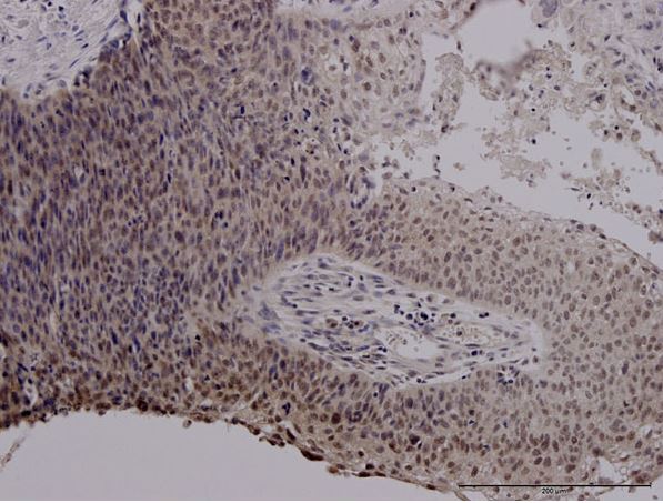 Immunohistochemistry (Formalin/PFA-fixed paraffin-embedded sections) - Anti-MIF antibody [2A10-4D3] (AB55445)