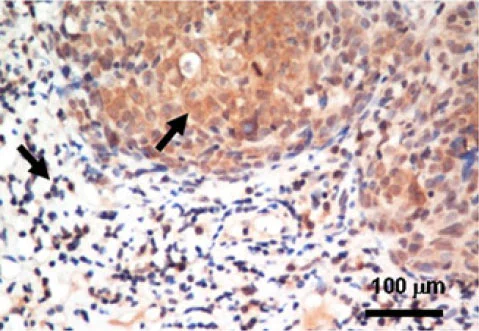Immunohistochemistry (Formalin/PFA-fixed paraffin-embedded sections) - Anti-MIF antibody [2A10-4D3] (AB55445)