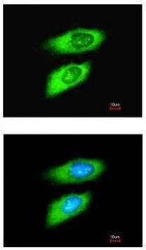 Immunocytochemistry/ Immunofluorescence - Anti-MIF antibody (AB227073)