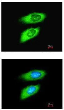 Immunocytochemistry/ Immunofluorescence - Anti-MIF antibody (AB227073)