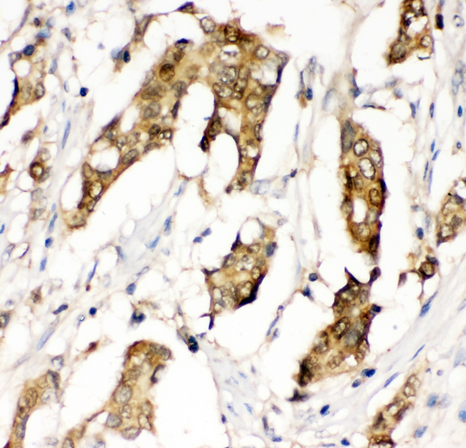 Immunohistochemistry (Formalin/PFA-fixed paraffin-embedded sections) - Anti-MIF antibody (AB65869), expandable thumbnail