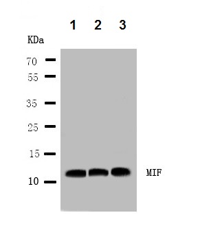 Western blot - Anti-MIF antibody (AB65869), expandable thumbnail