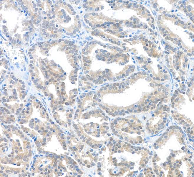 Immunohistochemistry (Formalin/PFA-fixed paraffin-embedded sections) - Anti-MIF antibody [BLR141J] - BSA free (AB314057), expandable thumbnail