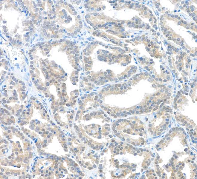 Immunohistochemistry (Formalin/PFA-fixed paraffin-embedded sections) - Anti-MIF antibody [BLR141J] - BSA free (AB314057)