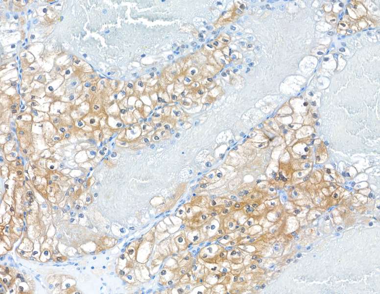 Immunohistochemistry (Formalin/PFA-fixed paraffin-embedded sections) - Anti-MIF antibody [BLR141J] - BSA free (AB314057), expandable thumbnail