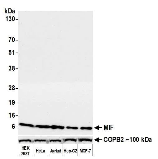 Western blot - Anti-MIF antibody [BLR141J] - BSA free (AB314057)