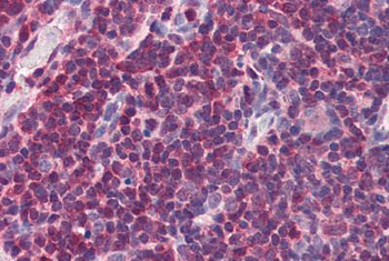 Immunohistochemistry (Formalin/PFA-fixed paraffin-embedded sections) - Anti-MIF antibody - C-terminal (AB189290), expandable thumbnail