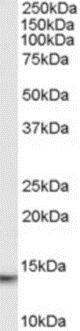 Western blot - Anti-MIF antibody - C-terminal (AB189290), expandable thumbnail