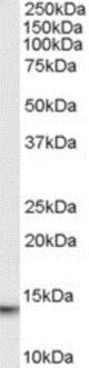 Western blot - Anti-MIF antibody - C-terminal (AB189290)