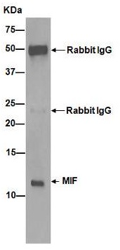 Immunoprecipitation - Anti-MIF antibody [EPR12463] (ab175189), expandable thumbnail