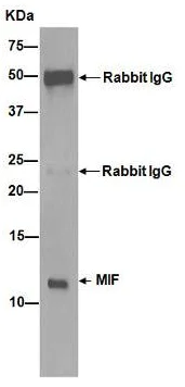 Immunoprecipitation - Anti-MIF antibody [EPR12463] (AB175189)