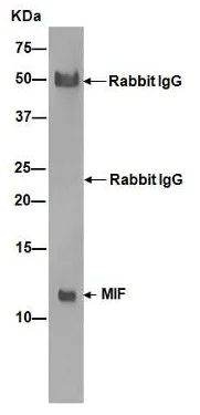 Immunoprecipitation - Anti-MIF antibody [EPR12463] (AB175189)