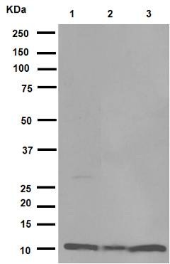 Western blot - Anti-MIF antibody [EPR12463] (AB175189), expandable thumbnail