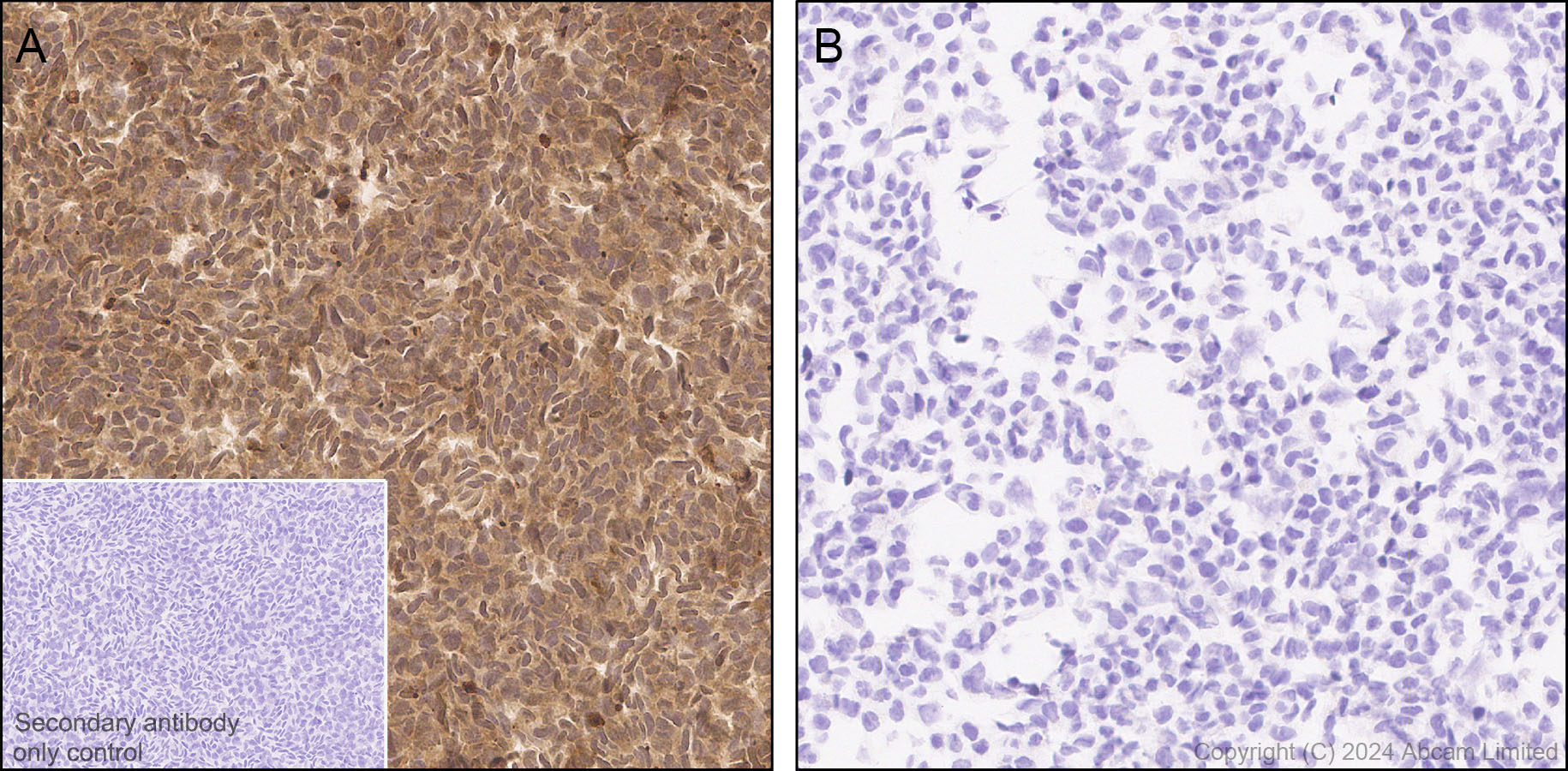 Anti-MIF antibody [RM1231] (ab322733) | Abcam