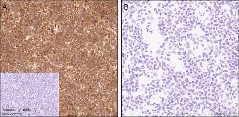 Immunohistochemistry (Formalin/PFA-fixed paraffin-embedded sections) - Anti-MIF antibody [RM1231] (AB322733)