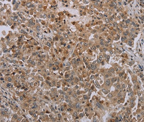 Immunohistochemistry (Formalin/PFA-fixed paraffin-embedded sections) - Anti-MIG-6 antibody (AB198834)