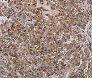 Immunohistochemistry (Formalin/PFA-fixed paraffin-embedded sections) - Anti-MIG-6 antibody (AB198834)
