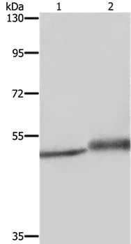 Western blot - Anti-MIG-6 antibody (AB198834)