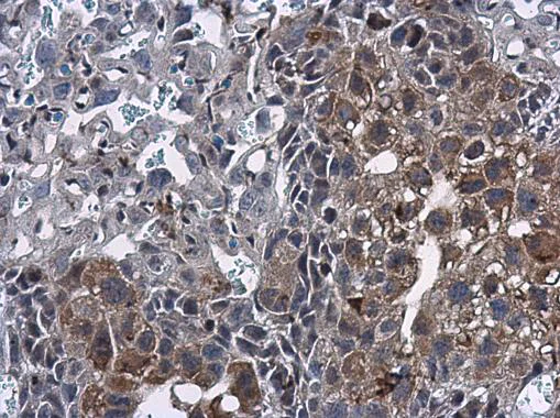 Immunohistochemistry (Formalin/PFA-fixed paraffin-embedded sections) - Anti-MIG-6 antibody (AB227944)