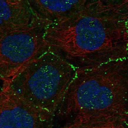Immunocytochemistry/ Immunofluorescence - Anti-Migfilin antibody (AB221929)