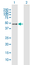 Western blot - Anti-MIIP antibody (AB167197), expandable thumbnail