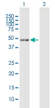 Western blot - Anti-MIIP antibody (AB167197)