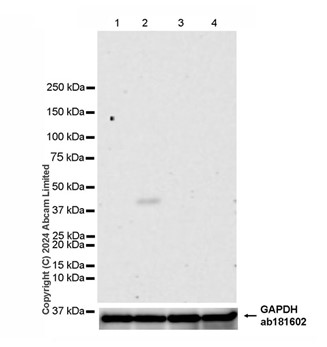 Western blot - Anti-Milk Fat Globule 1 antibody [EPR29114-57] (AB319152)