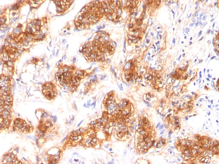 Immunohistochemistry (Formalin/PFA-fixed paraffin-embedded sections) - Anti-Milk Fat Globule 1 antibody [SPM291] (AB17787)